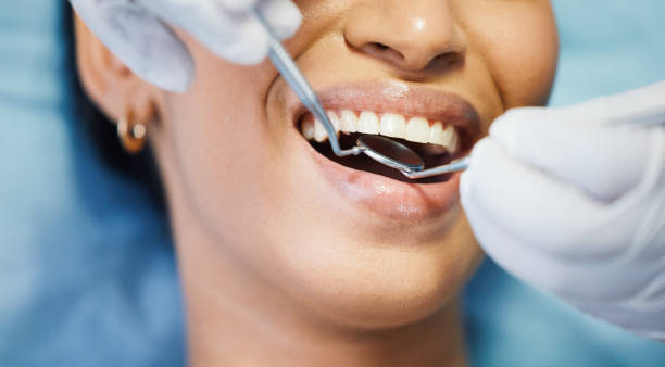 Best Emergency Dental Care for Broken or Chipped Teeth in Saint Davids, PA