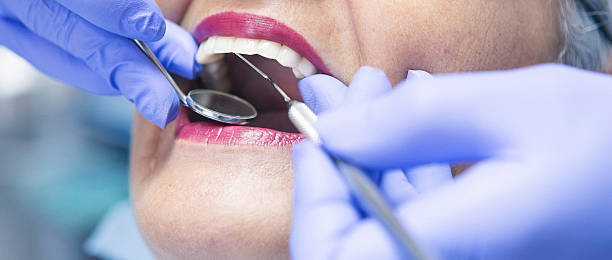 Best Emergency Treatment for Dental Infections or Abscesses in Saint Davids, PA
